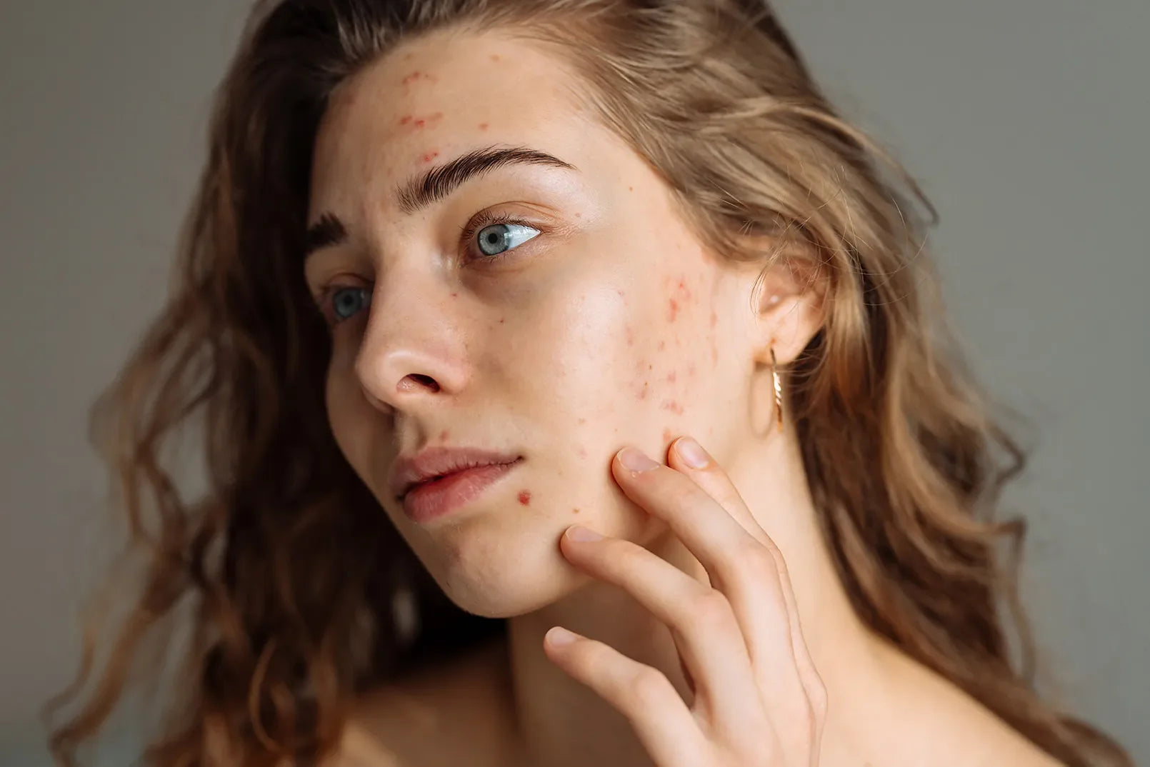 Why Your Skin Suddenly Looks Older After Stressful Weeks